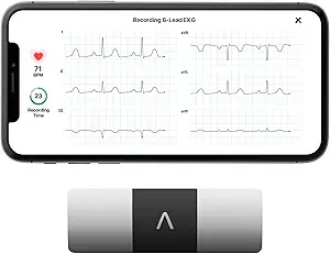 personal-ekg-heart-monitor